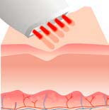 caci wrinkle comb after