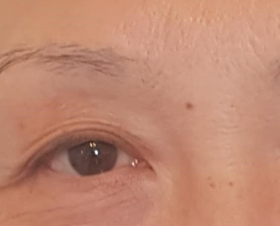 Client 2 brows before Client 2 brows before